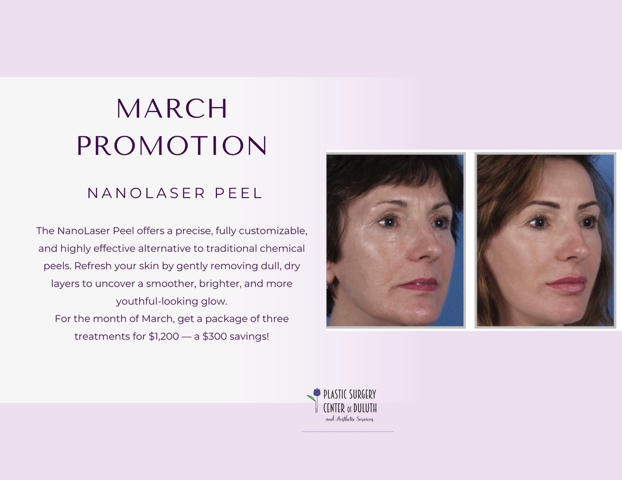 March Promo
