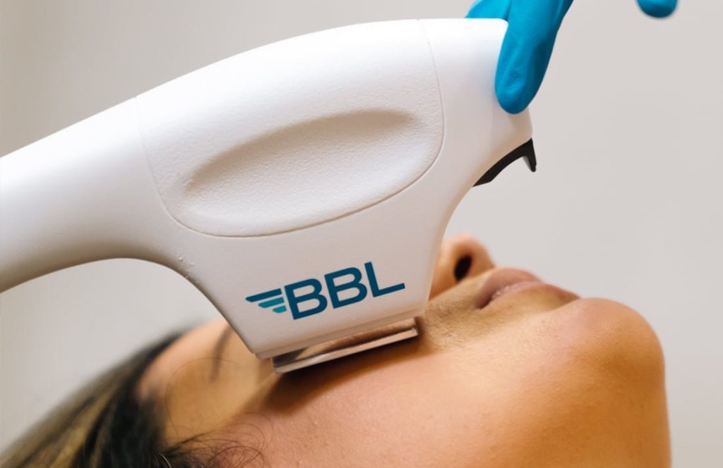 Defalted Bbl BBL SkinTyte - Duluth Plastic Surgery Center