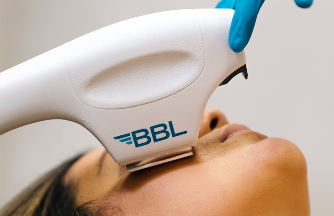 BBL® SkinTyte™